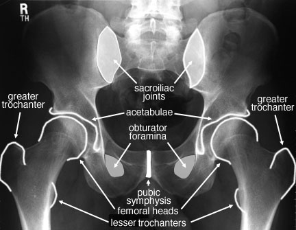 Radiographic Anatomy of the Skeleton: Hip -- Anteroposterior (AP) View