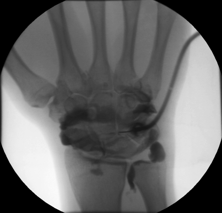 mr contrast injection mr contrast injection